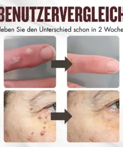 RZXEA™ All-in-1 Ceramide Hautcreme