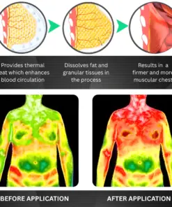 RZXEA™ Gynecomastia 3 in1 Nano Microneedle Patch