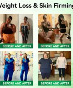 RZXEA™ Moringa Berberine NAD 10-in-1 Nano Microneedle Patch (𝐉𝐮𝐬𝐭 𝐨𝐧𝐜𝐞 𝐚 𝐝𝐚𝐲, 𝐯𝐢𝐬𝐢𝐛𝐥𝐞 𝐜𝐡𝐚𝐧𝐠𝐞𝐬 𝐢𝐧 𝟕 𝑫𝐚𝐲𝐬 𝐅𝐨𝐫 𝐎𝐛𝐞𝐬𝐢𝐭𝐲, 𝙇𝙊𝙊𝙎𝗘 𝗦𝗞𝗜𝗡,𝐝𝐢𝐚𝐛𝐞𝐭𝙚𝙨, 𝐬𝐥𝐞𝐞𝐏 𝐚𝐩𝐧𝐞𝐚, 𝐣𝐨𝐢𝐧𝐭 𝐢𝐬𝐬𝐮𝙚𝙨, 𝐚𝐧𝐝 𝐦𝐨𝐫𝐞