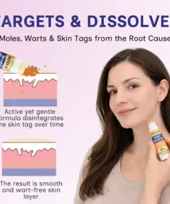 RZXEA™ Solid-Stick Wart Remover, Skin Tags in Just 48 Hours