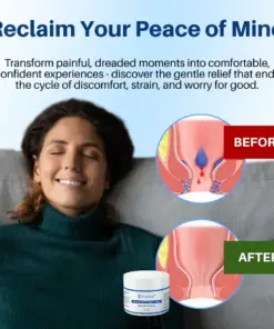 RZXEA™ Advanced Hemorrhoid & Fissure Relief Cream