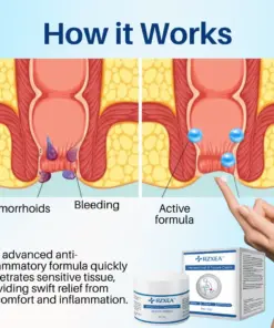 RZXEA™ Advanced Hemorrhoid & Fissure Relief Cream