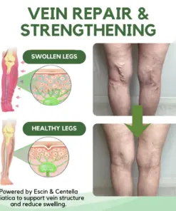 RZXEA™ Next-Gen Lymphatic Drainage & Vein Repair Cream