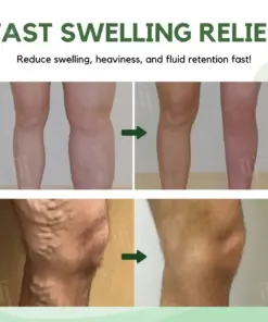 RZXEA™ Next-Gen Lymphatic Drainage & Vein Repair Cream