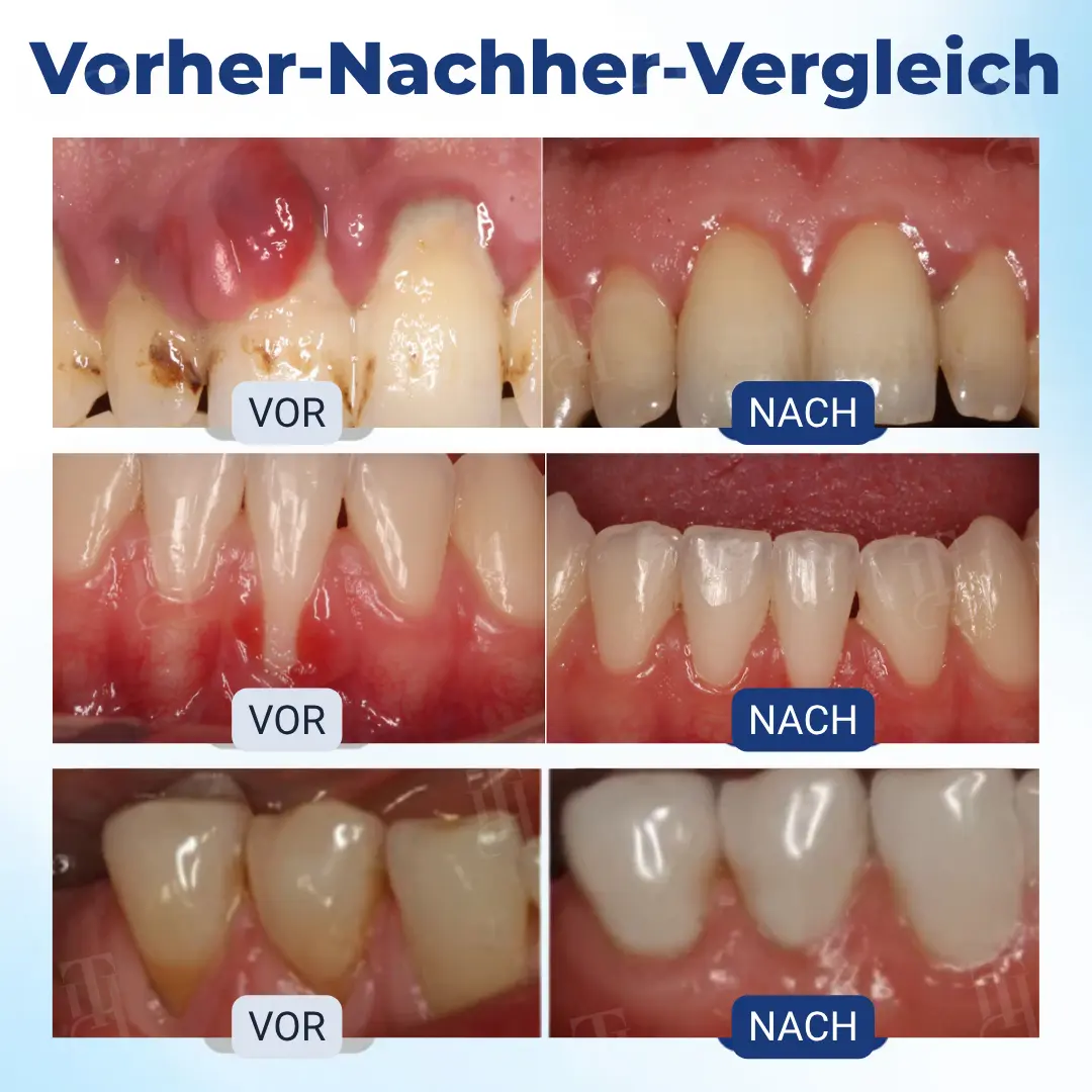 RZXEA™ Postbiotics Bee Gumcare-Lösung