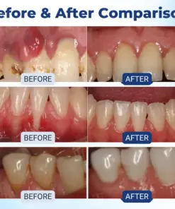 RZXEA™ Postbiotics Bee Gumcare Solution