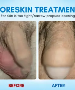 RZXEA™ Foreskin Elasticity Gel