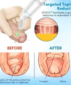 RZXEA™ Foreskin Elasticity Gel